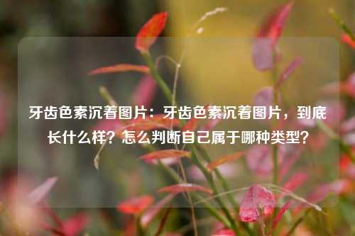 牙齿色素沉着图片：牙齿色素沉着图片，到底长什么样？怎么判断自己属于哪种类型？